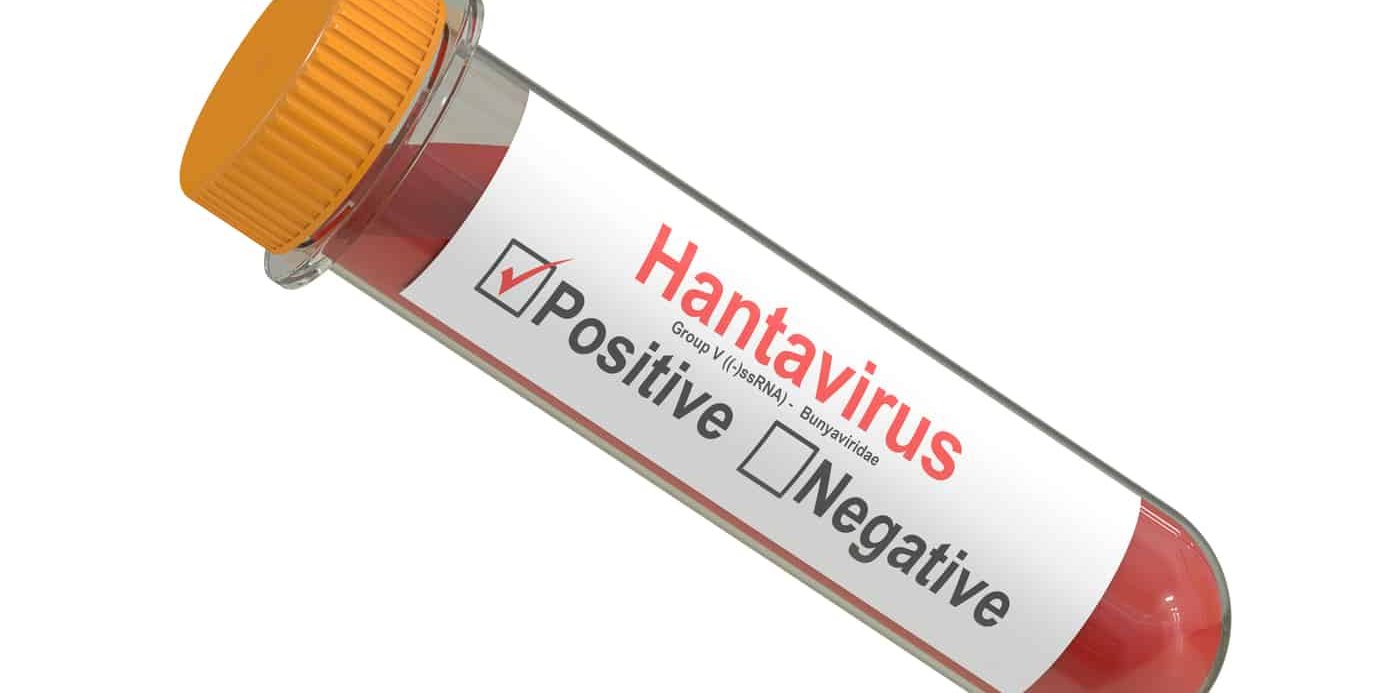 hantavirus test
