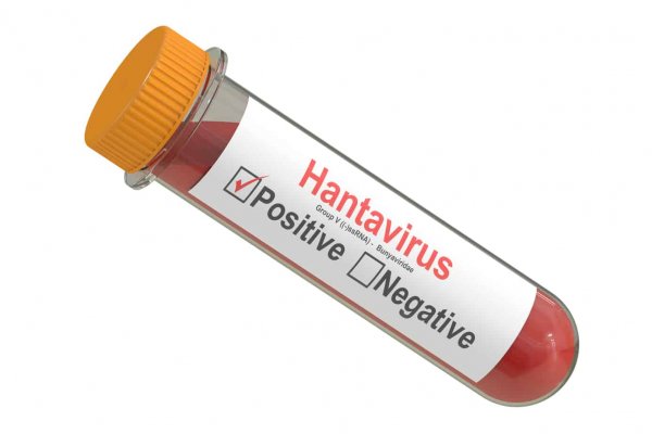 hantavirus test